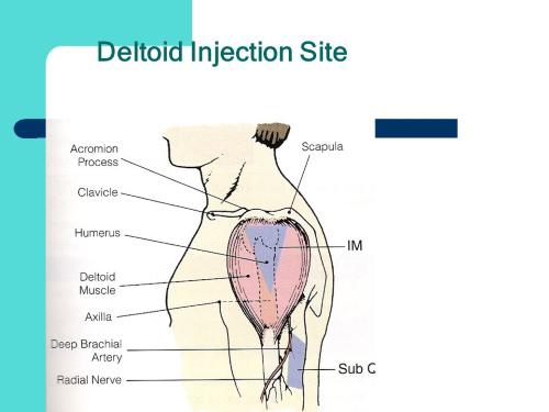 Inject Testosterone via the Deltoid Site is less desirable
