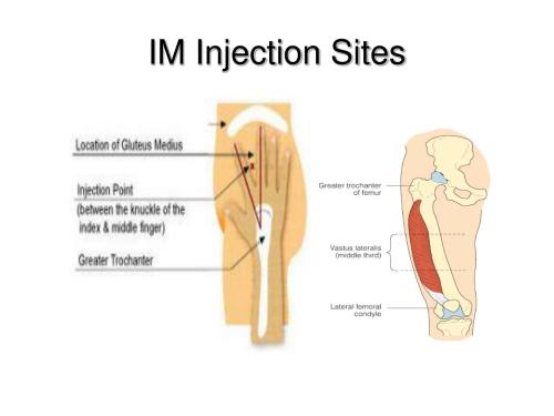 best spots to inject testosterone