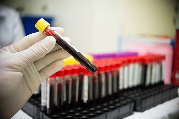 aboratory technician holding a blood tube test