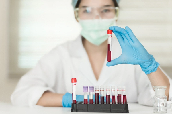 asian female doctor holds blood sample