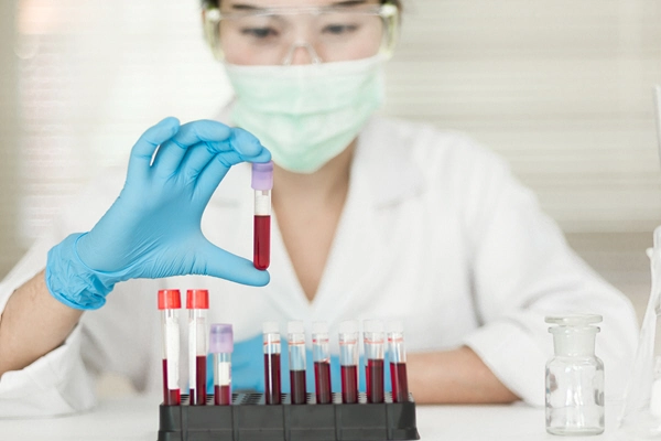asian female doctor looks at blood sample