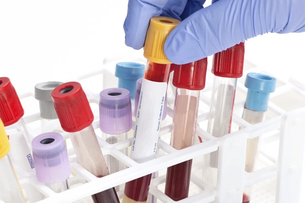 blood analysis collection tube selected by lab technician