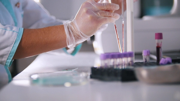 blood analysis in labratory