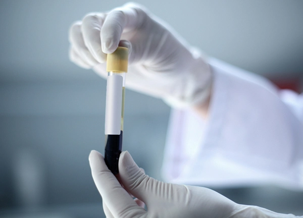 blood test tube in a womans hands