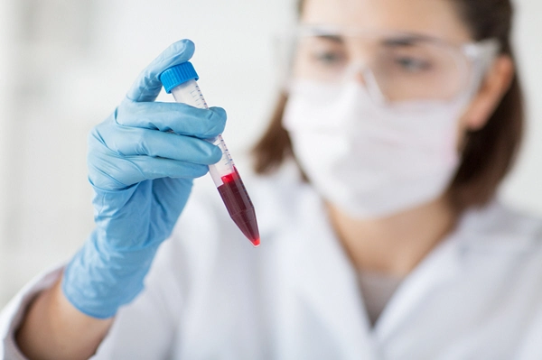 close up of young female scientist holding tube with blood sample