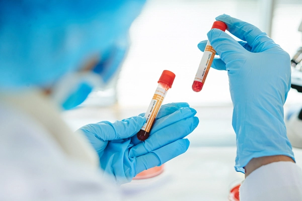 close up shot of unrecognizable doctor wearing rubber gloves and white coat holding blood test tubes