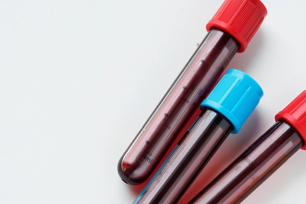 closeup of blood tube test