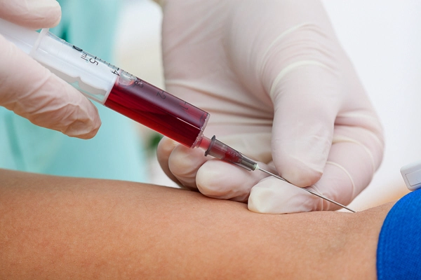 closeup of nurses hands taking a blood sample