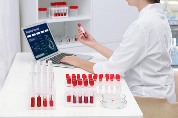 doctor does analysis of a tube of blood with computer