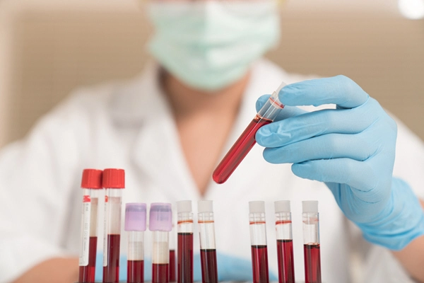 doctor examines blood sample from rack