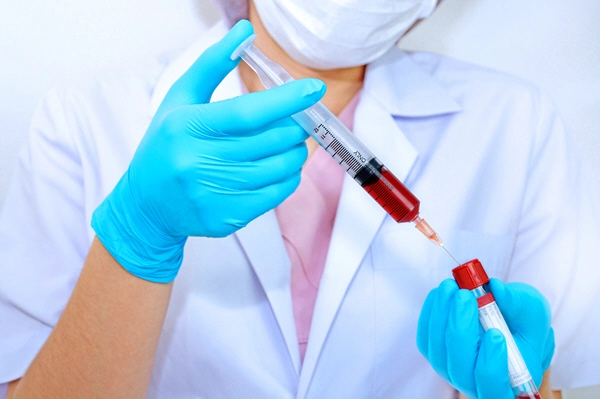 doctor examines blood sample