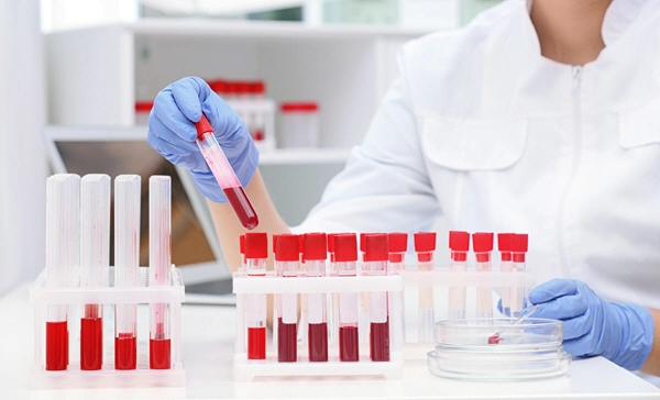 doctor examines blood vile from rack