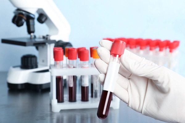 doctor holding glass tube with blood in laboratory