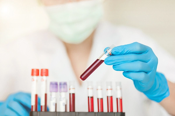 doctor holds blood sample from rack 2