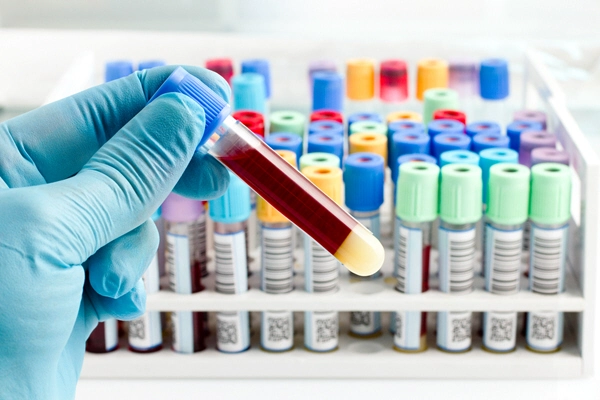 doctor holds blood sample from rack