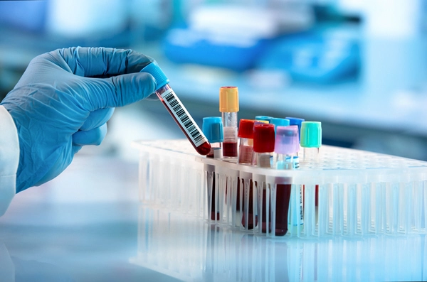 doctor holds blood sample