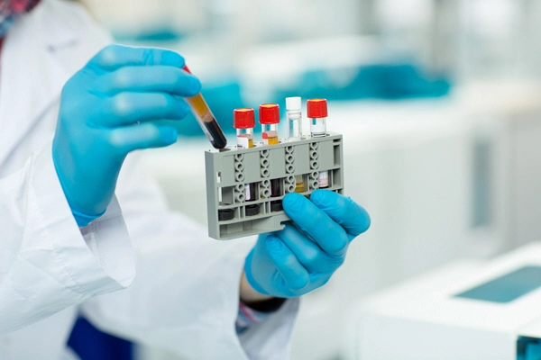 doctor holds rack of blood samples