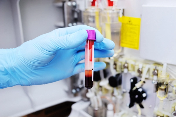 doctor holds sample of blood in lab