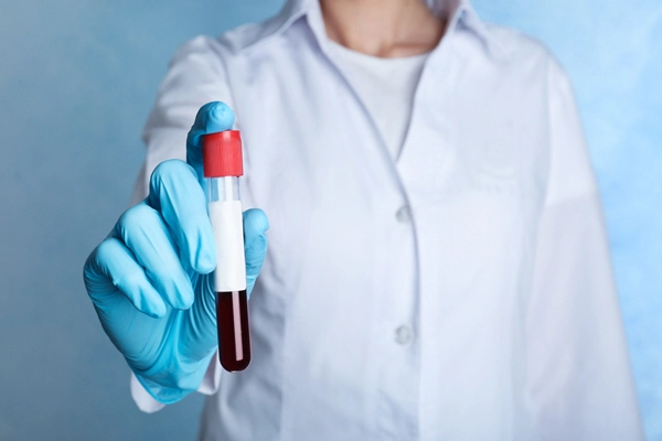 doctor holds tube of blood