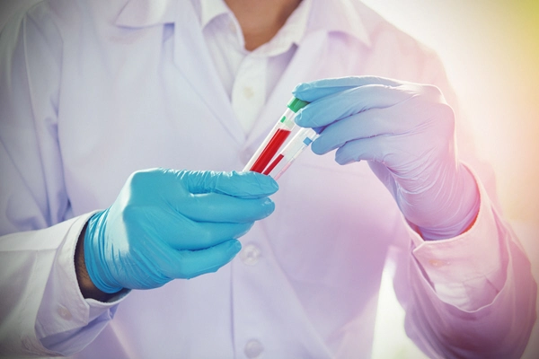 doctor holds two samples of blood