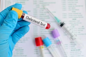 Cholesterol blood test 300x200