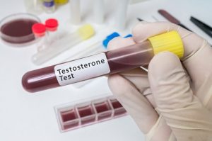 testosterone blood test 300x199